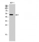 ERβ Polyclonal Antibody