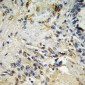 ETS1 Polyclonal Antibody