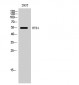 ETS1 Polyclonal Antibody