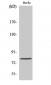 Ezrin Polyclonal Antibody