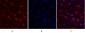 FAK Polyclonal Antibody