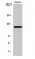 FAK Polyclonal Antibody