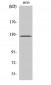 FAK Polyclonal Antibody