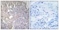 FAK Polyclonal Antibody