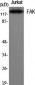 FAK Polyclonal Antibody