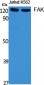 FAK Polyclonal Antibody