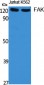 FAK Polyclonal Antibody