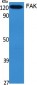 FAK Polyclonal Antibody