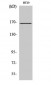 FANCD2 Polyclonal Antibody