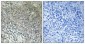 FASTKD3 Polyclonal Antibody