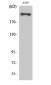 Fatty Acid Synthase Polyclonal Antibody