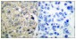 FGFR-3 Polyclonal Antibody