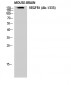 Flt-1 Polyclonal Antibody