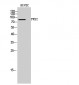 FRS2 Polyclonal Antibody