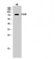 FSHR Polyclonal Antibody