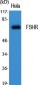 FSHR Polyclonal Antibody