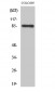 Fyb Polyclonal Antibody