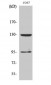 GABAB R1 Polyclonal Antibody