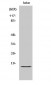 GADD 45γ Polyclonal Antibody