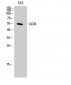 GCK Polyclonal Antibody