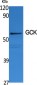 GCK Polyclonal Antibody