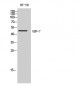 GDF-7 Polyclonal Antibody