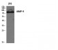 MMP-9 Polyclonal Antibody