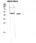 GFAP Polyclonal Antibody