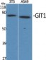 GIT1 Polyclonal Antibody