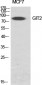 GIT2 Polyclonal Antibody