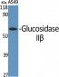 Glucosidase IIβ Polyclonal Antibody