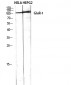 GluR-1 Polyclonal Antibody