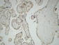 Glut1 Polyclonal Antibody