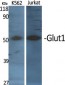 Glut1 Polyclonal Antibody