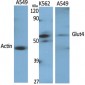 Glut4 Polyclonal Antibody