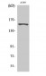 GPR116 Polyclonal Antibody