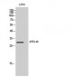 GPR146 Polyclonal Antibody