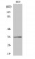 GPR18 Polyclonal Antibody