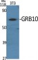 GRB10 Polyclonal Antibody