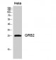 GRB2 Polyclonal Antibody