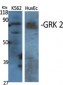 GRK 2 Polyclonal Antibody