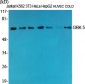 GRK 5 Polyclonal Antibody