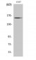 GTBP Polyclonal Antibody