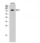 HBO1 Polyclonal Antibody