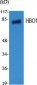 HBO1 Polyclonal Antibody