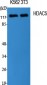 HDAC5 Polyclonal Antibody