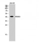 HDAC8 Polyclonal Antibody