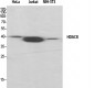 HDAC8 Polyclonal Antibody