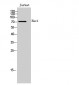 Hec1 Polyclonal Antibody