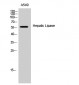 Hepatic Lipase Polyclonal Antibody